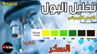 Urinalysis 9 chemical ex Glucose dipstick [upl. by Llertnahs715]