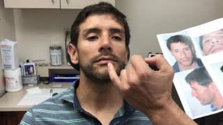 Male Rhinoplasty  Correcting the Twisted Nose  Dr Jeffrey Epstein [upl. by Hartill858]