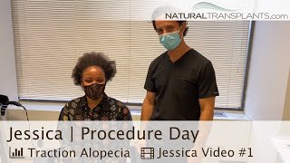 Natural Transplants Procedure Thinning Edges Hair Loss in Female  Dr Kevin Blumenthal Jessica [upl. by Duval202]