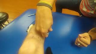 How to Fit and Use a Dyna Splint Ankle Brace for Equinus Contracture [upl. by Aronoh]