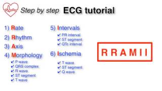 ECG Basics 110  Introduction and Approach to the ECG [upl. by Rosenblatt555]