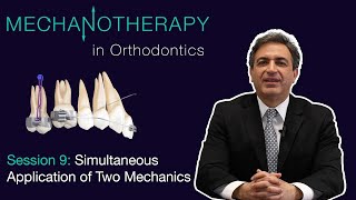 Mechanotherapy in Orthodontics Vol II Simultaneous Application of Two Mechanics 009 [upl. by Nnairrek]