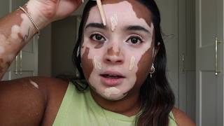 HOW I DO MY MAKEUP WITH VITILIGO [upl. by Neeliak]