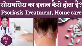 Psoriasis Treatment In Hindi  सोरायसिस का इलाज हिंदी में [upl. by Dawes]