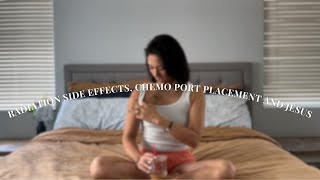 Stage 2 Rectal Cancer  Radiation  Oral Chemo side effects  Chemo Port Placement [upl. by Atrim]