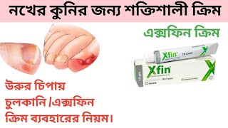 xfin cream এর কাজ কি।xfin cream ব্যবহার নিয়ম।xfin cream review in bangla [upl. by Woodrow289]