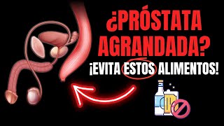 EVITA Estos Alimentos Si tienes la PRÓSTATA AGRANDADA [upl. by Htebizile]