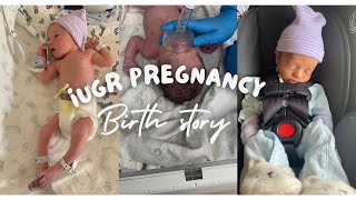 IUGR PREGNANCYBIRTH STORY [upl. by Kirt]