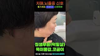 내몸이 알려주는 치매 뇌졸중 파킨슨병 심장질환 신호 8가지💥얼굴부종 귓볼주름 혀백태 탈모 눈충혈 팔자주름 침샘부음 [upl. by Montano]