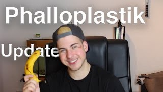 FTM  Phalloplastik Update 1 12 Jahre Post OP  Geschlechtsangleichung Frau zu Mann Transsexuell [upl. by Eudocia636]