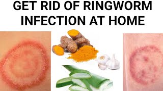 Home remedies for ringworm infection [upl. by Bledsoe759]