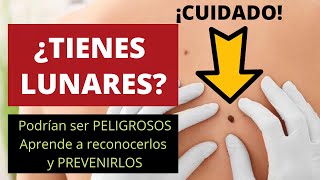 ¡CUIDADO ¿TIENES LUNARES Podrían ser peligrosos aprende a reconocerlos y prevenirlos [upl. by Tryck]