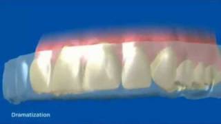 How Crest 3D Whitestrips Work [upl. by Kyriako]