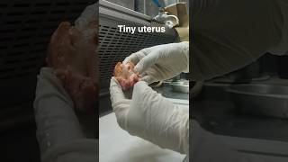 Tiny uterus  histopathology [upl. by Kaiser]