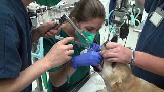 Administering Propofol for sedation and placing the endotracheal tube [upl. by Shandra]