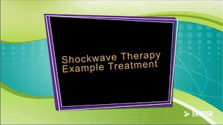 Revolutionary Pneumatic Shockwave Therapy Machine  ED Treatment amp Physiotherapy Tool  10 Bars Powe [upl. by Laucsap186]