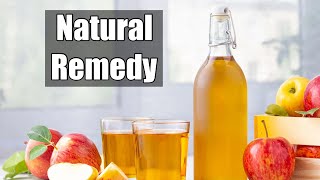 Apple Cider Vinegar To Treat Psoriasis [upl. by Nawram]