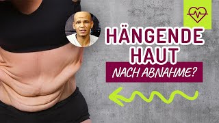 Hängende Haut nach Abnahme Bekomme ich es durch Sport weg  HILFE  Coach Cecil [upl. by Notyap]