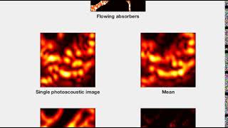 Super Resolution Photoacoustic Imaging [upl. by Borgeson109]