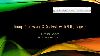 Are you a FIJI ImageJ beginner [upl. by Jezreel52]