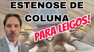 Estenose da Coluna para LEIGOS  Entenda o que é estenose a anatomia e alterações da ressonância [upl. by Niboc]