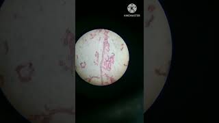 Sycon in microscope like subscribe for more videos BSc [upl. by Nyleve]