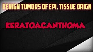 KERATOACANTHOMA  BENIGN EPI TUMOR [upl. by Ahsinet419]