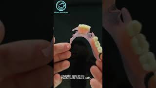 valplast partial denture dentallab valplast partialdenture [upl. by Ahteres]