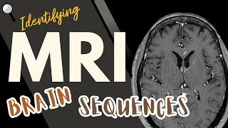 Identifying MRI Brain Sequences [upl. by Nicolella]