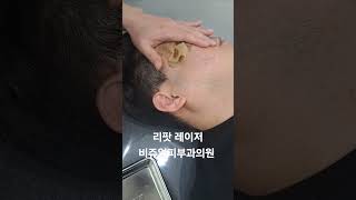 리팟 레이저 다발성 흑자 세종리팟 세종시리팟 reepot lentigo multiplelentigo 청주리팟 공주리팟 대전리팟 오창리팟 오송리팟 부여리팟 [upl. by Venita]