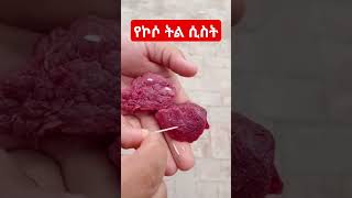 የኮሶ ትል ሲስት በጥሬ ሥጋ ላይ  Live beef tape worm  taeniasis subscribe healthbreak [upl. by Eben]