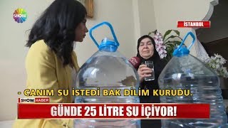 Günde 25 litre su içiyor [upl. by Mateya]