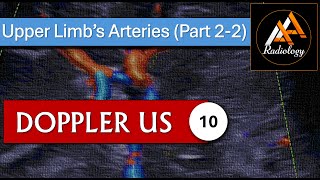 10  Upper Limbs Arteries Part 22 [upl. by Grannia]