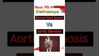 Aortic Stenosis Heart sound audio on stethoscope medical neetpg2024 aiims [upl. by Lexis]