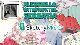 Klebsiella Enterobacter Serratia  SketchyMicro  Sketchy Medical USMLE Step 1 [upl. by Htide793]