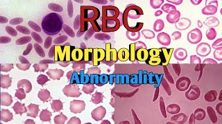 RBC Morphology  Anisocytosis Poikilocytosis  RBC shape amp Size Abnormality [upl. by Duma]