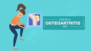 Que es la Osteoartritis  Artrosis 🔎🦴  Expertos en OA [upl. by Prudence]