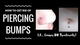 Piercing Bumps 101 Identification and Treatments [upl. by Adiela]