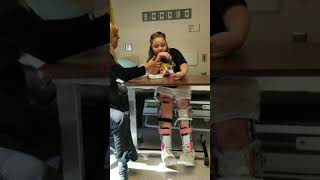 Arthrogryposis Diagnosis and Treatment  Patient Testimonial Aubrey [upl. by Daukas]