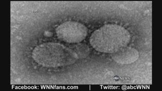 New SARSLike Virus With No Cure Kills at Least 27 [upl. by Viviane]