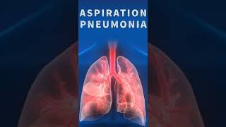 Aspiration pneumonia [upl. by Omocaig]