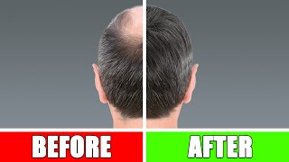 STOP Thinning Hair In Its Tracks  Top Tips For Hair Loss More Volume amp Thin Hair thinninghair [upl. by Leiruh]