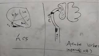 antiplatelet and anticoagulant in myocardial infarction [upl. by Ingles]