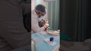 Treatment of fixed tooth Dental procedure by Dr I B BDS MDS RADHA DENTAL CLINICtoothdoctor [upl. by Yrrap368]