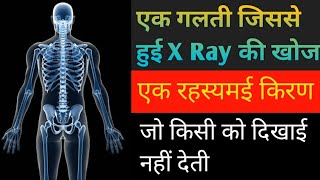 Discovery of Xray  एक्सरे की खोज  xray radiology Part1 USMAN USTA  CANNON OF INFORMATION [upl. by Tamanaha]