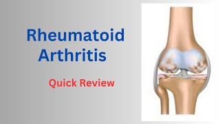 Rheumatoid Arthritis Diagnostic Criteria amp Management  Part2  Chapter11 [upl. by Arjun]