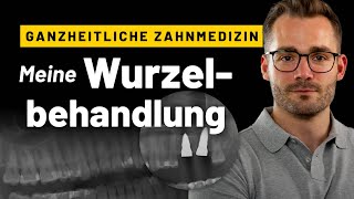 Darum habe ich meine wurzelbehandelten Zähne entfernen lassen 3 Tage bei Dr Dominik Nischwitz [upl. by Silra906]