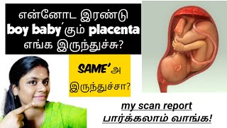 gender prediction during pregnancy in tamil  how to find baby boy or girl in scan report in tamil [upl. by Russi56]