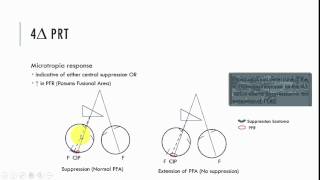 4pd Prism Test [upl. by Ecirtaed]