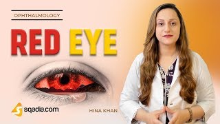 Red Eye  Episcleritis  Ophthalmology Video Lectures  Medical Education  VLearning [upl. by Toh]